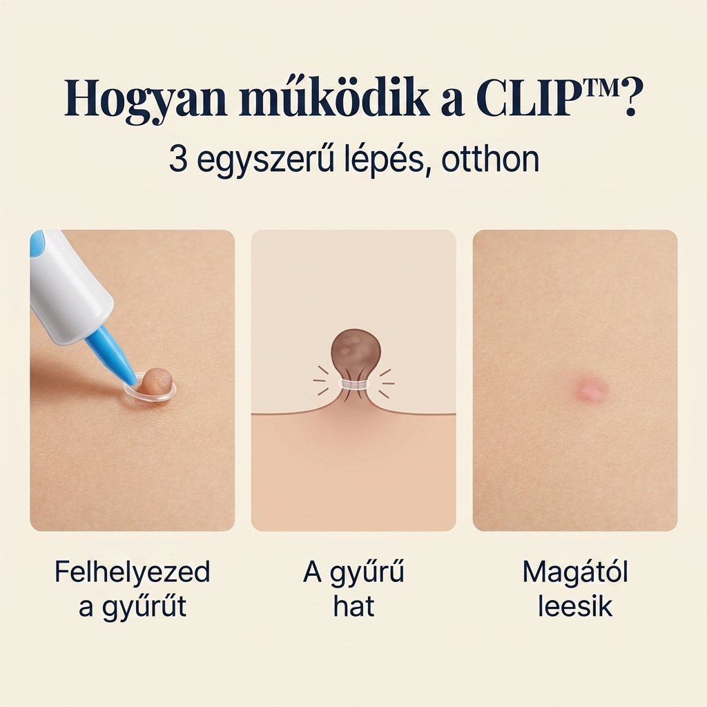CLIP