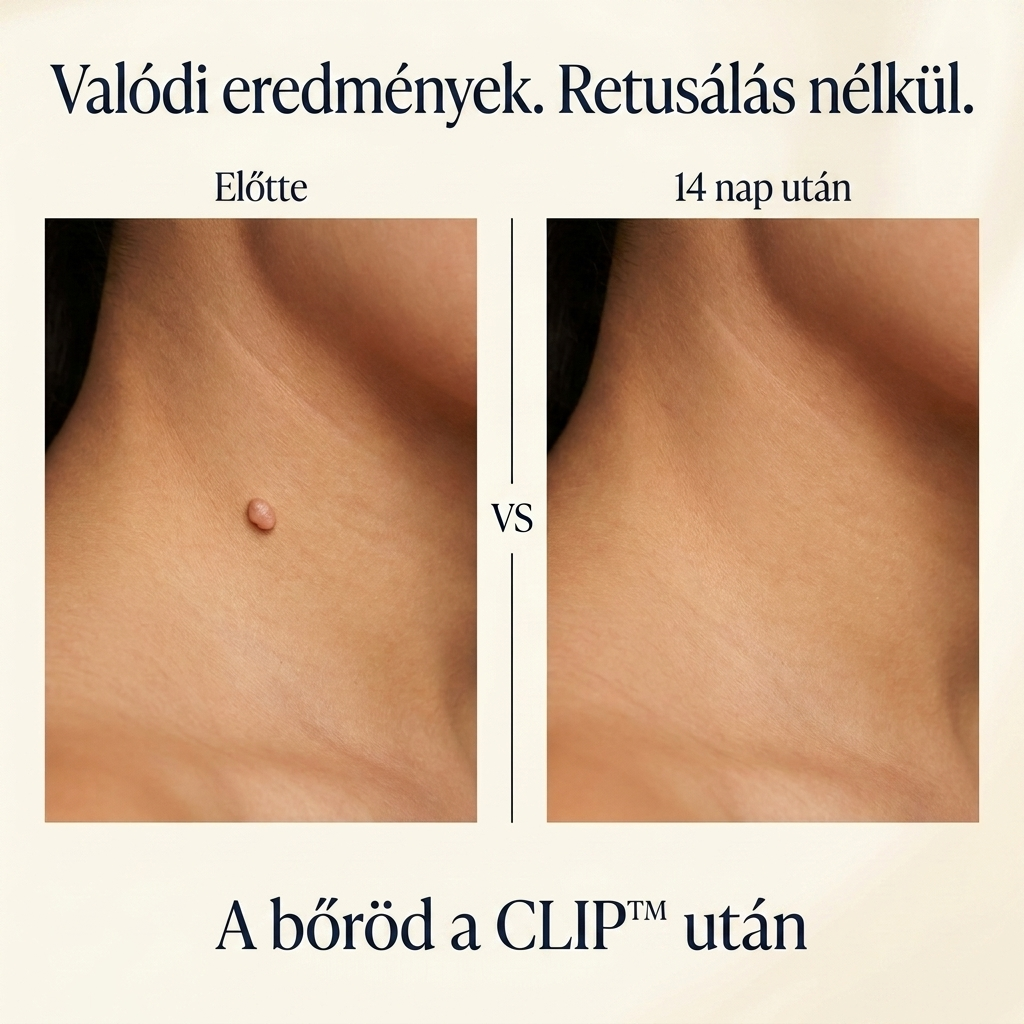 CLIP